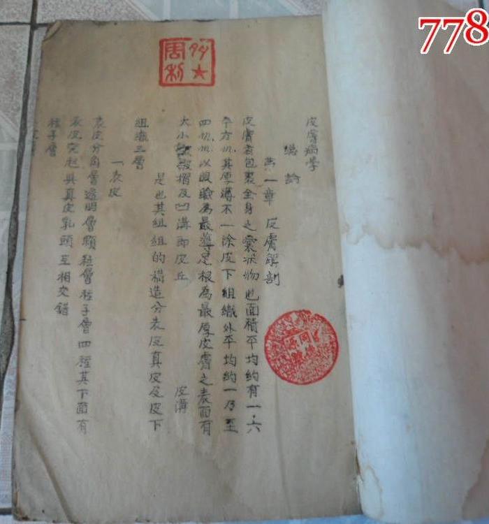 240清代花柳病学一特厚册、包含艾滋病、梅毒