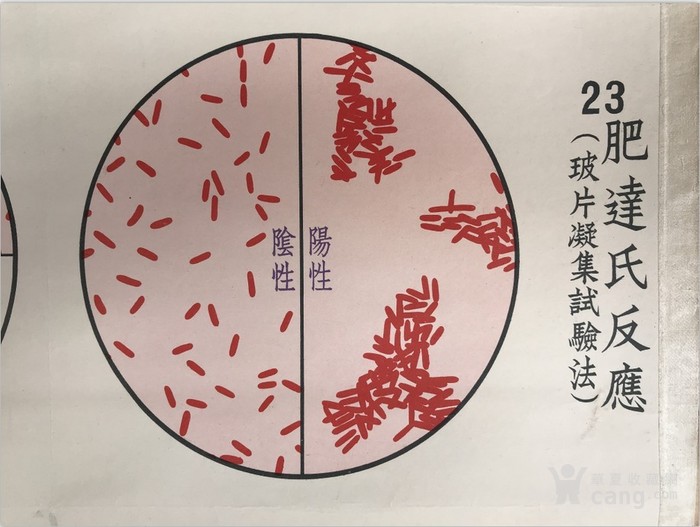 细菌学图谱 伤寒杆菌等